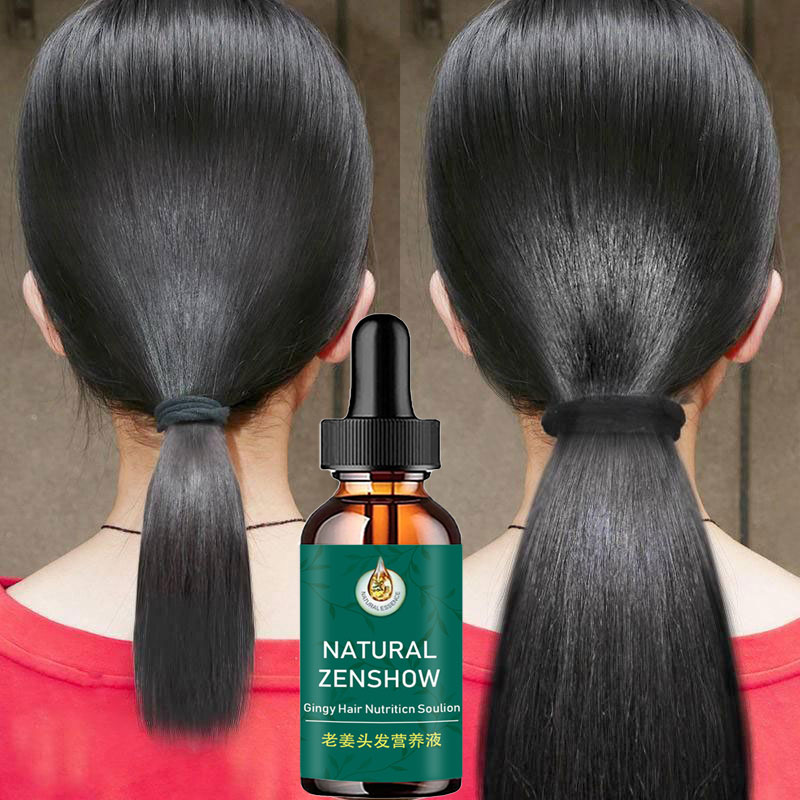 Hair Care Herbal - Zencefil saç büyüme uçucu yağ bitkisel