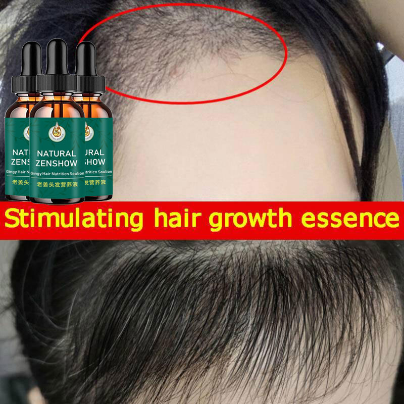 Zencefil saç büyüme uçucu yağ  - Hair Care Herbal incelemesi ve fiyatı