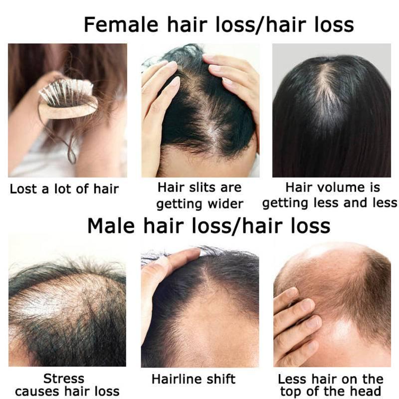 Zencefil saç büyüme uçucu yağ  - Hair Care Herbal incelemesi ve fiyatı