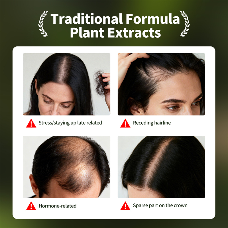 Doğal Saç Çıkarma Seti Usman Ç - Hair Care Herbal incelemesi ve fiyatı