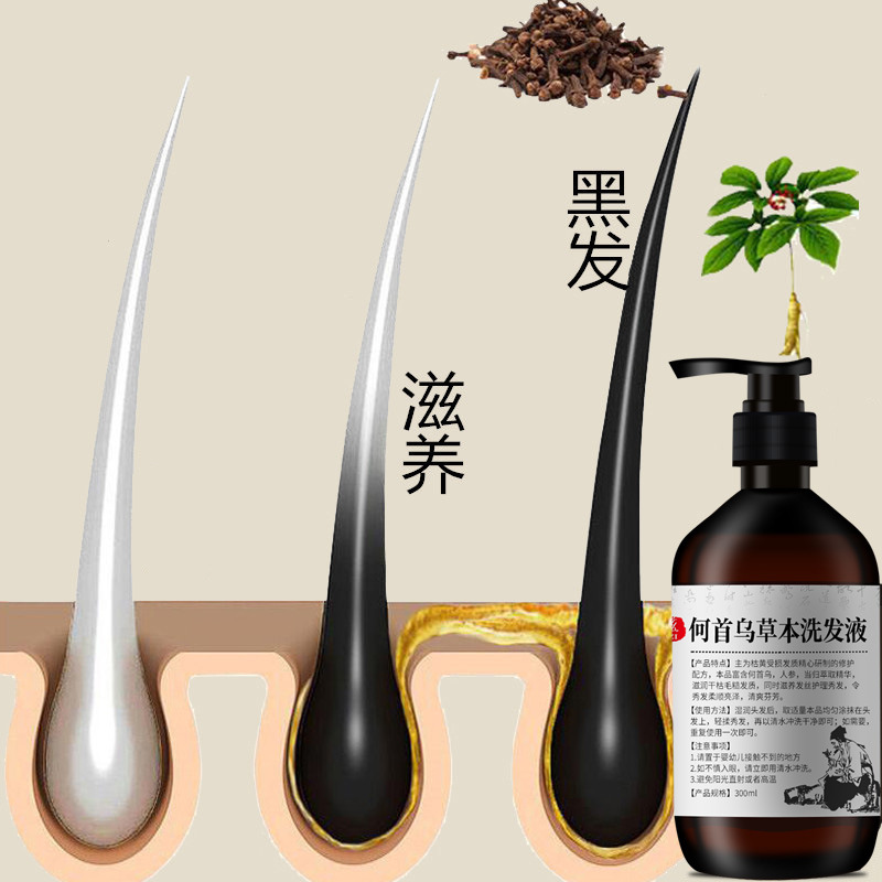 300ml Polygonum multiflorum şa - Hair Care Herbal incelemesi ve fiyatı