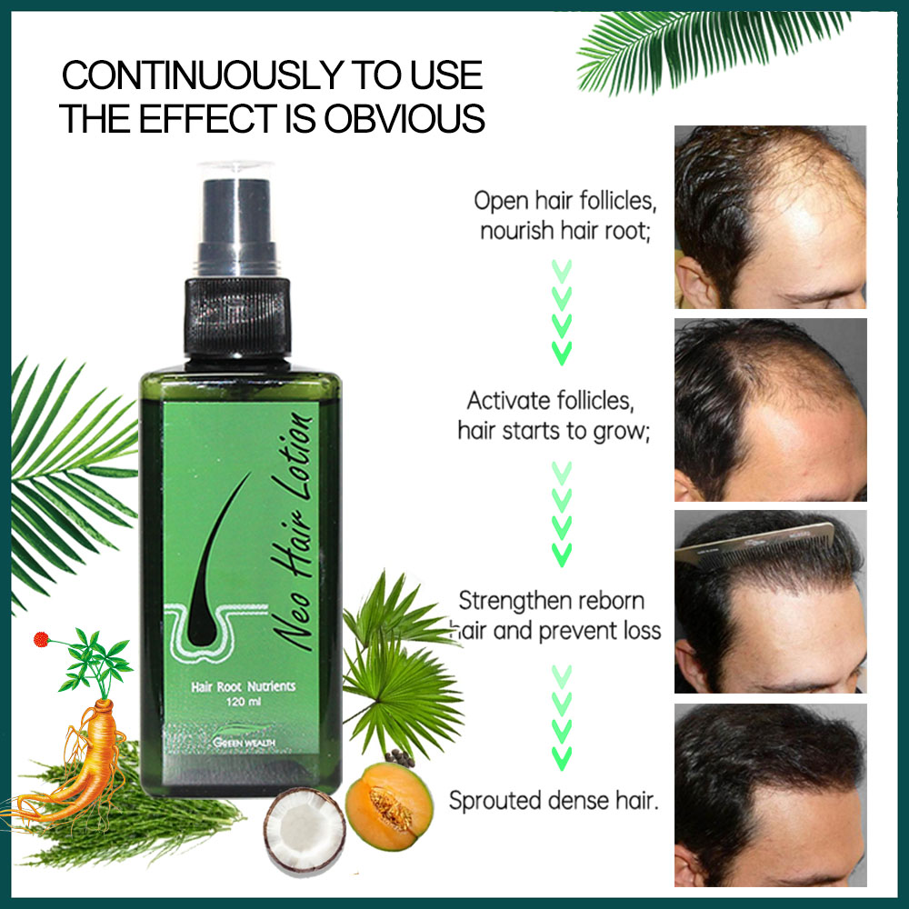 Orijinal Neo Saç Losyonu 120ml - Hair Care Thailand incelemesi ve fiyatı