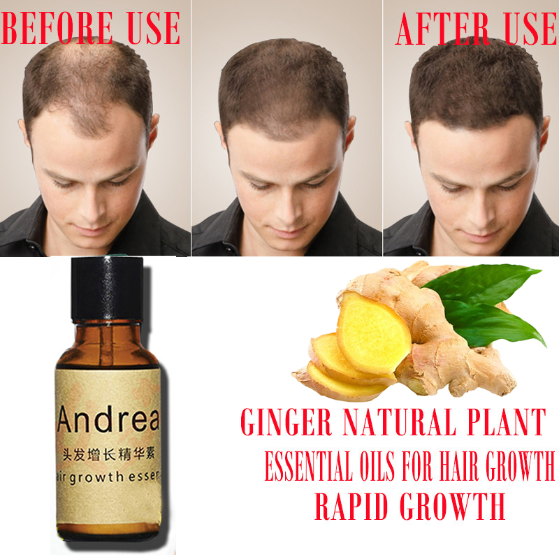 2/5/10 adet Andrea Saç Büyüme  - Hair Care Herbal incelemesi ve fiyatı