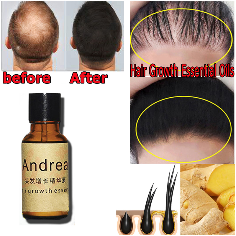 2/5/10 adet Andrea Saç Büyüme  - Hair Care Herbal incelemesi ve fiyatı