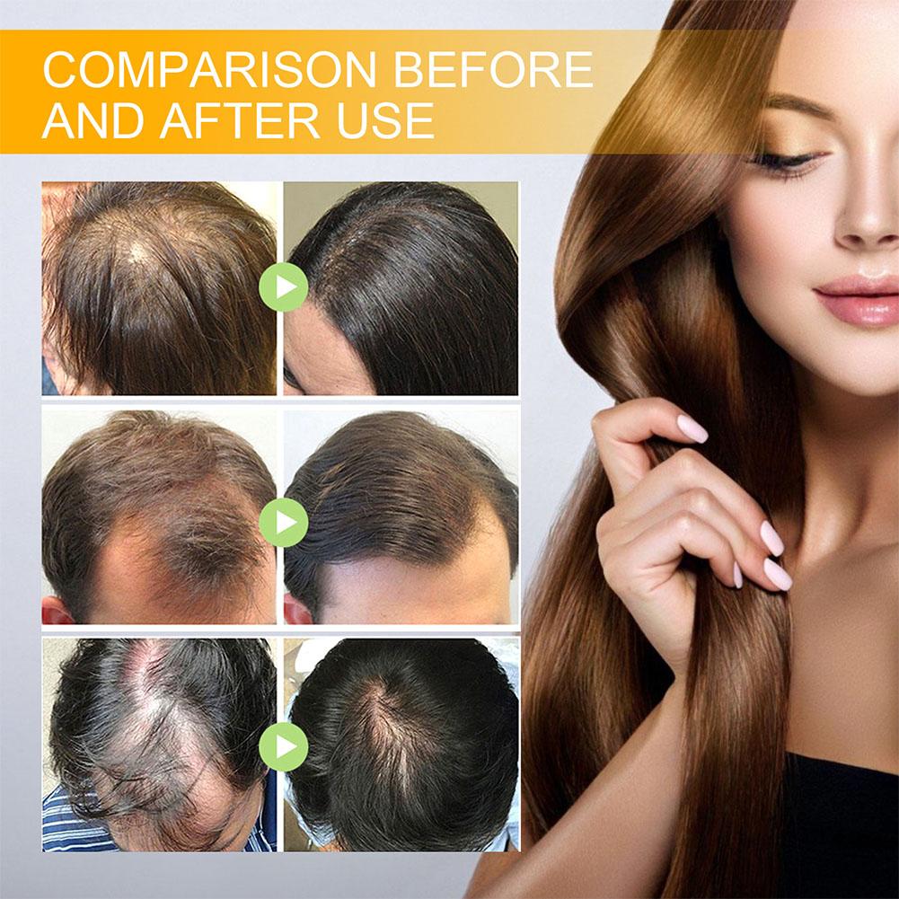 5/3/1 adet Biotin Hızlı Saç Bü - Hair Care Herbal incelemesi ve fiyatı